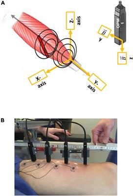 Optically pumped magnetometers detect altered maximal muscle activity in neuromuscular disease